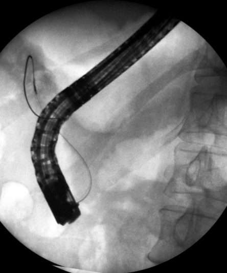 1.2.826.0.1.3680043.9.3558.1.4.313656339.2272.1647387887.255.16